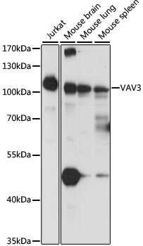 VAV3 Antibody - Western blot analysis of Jurkat cell lysate and mouse brain, lung and spleen tissue lysates using Rabbit anti VAV3 antibody at a 1/1000 dilution. 3% non-fat dry milk was used for blocking.