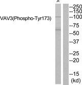 VAV3 Antibody - Western blot analysis of extracts from JK cells, using VAV3 (Phospho-Tyr173) antibody.