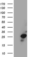 VAX1 Antibody - HEK293T cells were transfected with the pCMV6-ENTRY control. (Left lane) or pCMV6-ENTRY VAX1. (Right lane) cDNA for 48 hrs and lysed. Equivalent amounts of cell lysates. (5 ug per lane) were separated by SDS-PAGE and immunoblotted with anti-VAX1. (1:2000)