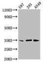 VAX1 Antibody - Positive Western Blot detected in U87 whole cell lysate, 293 whole cell lysate.A549 whole cell lysate. All lanes: VAX1 antibody at 3.8 µg/ml Secondary Goat polyclonal to rabbit IgG at 1/50000 dilution. Predicted band size: 35, 22 KDa. Observed band size: 35 KDa