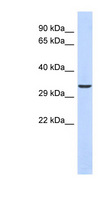 VAX1 Antibody - VAX1 antibody Western blot of Mouse Lung lysate. This image was taken for the unconjugated form of this product. Other forms have not been tested.