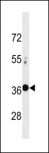 VAX2 Antibody - VAX2 Antibody western blot of A549 cell line lysates (35 ug/lane). The VAX2 antibody detected the VAX2 protein (arrow).
