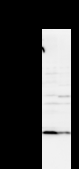 VAX2 Antibody - Detection of VAX2 by Western blot. Samples: Whole cell lysate from human A2058 (H, 50 ug) and mouse NIH3T3 (M, 50 ug) cells. Predicted molecular weight: 30 kDa