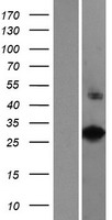 VAX2 Protein - Western validation with an anti-DDK antibody * L: Control HEK293 lysate R: Over-expression lysate