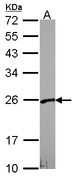 VBP1 Antibody - Sample (30 ug of whole cell lysate). A: A549. 12% SDS PAGE. VBP1 antibody diluted at 1:1000.