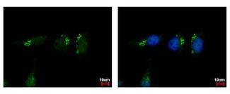 VBP1 Antibody - VBP1 antibody detects VBP1 protein at cytoplasm by immunofluorescent analysis. HeLa cells were fixed in ice-cold MeOH for 5 min. VBP1 protein stained by VBP1 antibody diluted at 1:500.