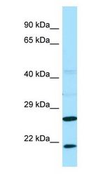 VBP1 Antibody - VBP1 antibody Western Blot of Fetal Liver.  This image was taken for the unconjugated form of this product. Other forms have not been tested.
