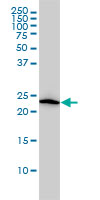 VBP1 Antibody - VBP1 monoclonal antibody (M01), clone 3D11 Western blot of VBP1 expression in HL-60.