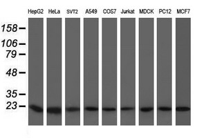 VBP1 Antibody - Western blot of extracts (35 ug) from 9 different cell lines by using anti-VBP1 monoclonal antibody (HepG2: human; HeLa: human; SVT2: mouse; A549: human; COS7: monkey; Jurkat: human; MDCK: canine; PC12: rat; MCF7: human).