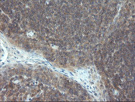 VBP1 Antibody - IHC of paraffin-embedded Human tonsil using anti-VBP1 mouse monoclonal antibody. (Heat-induced epitope retrieval by 10mM citric buffer, pH6.0, 100C for 10min).
