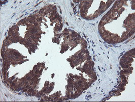 VBP1 Antibody - IHC of paraffin-embedded Human prostate tissue using anti-VBP1 mouse monoclonal antibody.
