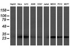 VBP1 Antibody - Western blot of extracts (35 ug) from 9 different cell lines by using g anti-VBP1 monoclonal antibody (HepG2: human; HeLa: human; SVT2: mouse; A549: human; COS7: monkey; Jurkat: human; MDCK: canine; PC12: rat; MCF7: human).