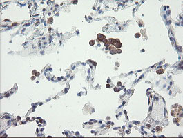VBP1 Antibody - IHC of paraffin-embedded Human lung tissue using anti-VBP1 mouse monoclonal antibody.