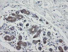 VBP1 Antibody - IHC of paraffin-embedded Human breast tissue using anti-VBP1 mouse monoclonal antibody.