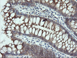 VBP1 Antibody - IHC of paraffin-embedded Human colon tissue using anti-VBP1 mouse monoclonal antibody.