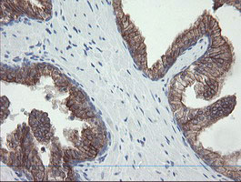 VBP1 Antibody - IHC of paraffin-embedded Human prostate tissue using anti-VBP1 mouse monoclonal antibody.