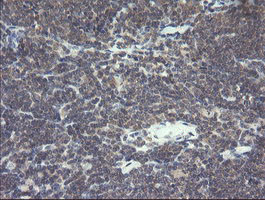 VBP1 Antibody - IHC of paraffin-embedded Human lymphoma tissue using anti-VBP1 mouse monoclonal antibody.