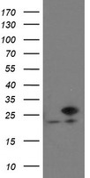 VBP1 Antibody - HEK293T cells were transfected with the pCMV6-ENTRY control (Left lane) or pCMV6-ENTRY VBP1 (Right lane) cDNA for 48 hrs and lysed. Equivalent amounts of cell lysates (5 ug per lane) were separated by SDS-PAGE and immunoblotted with anti-VBP1.