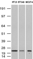 VBP1 Antibody - Western Blot analysis of HT-29, BT-549 and MOLT-4 cell lysates. (35µg) by using anti-VBP1 monoclonal antibody. (Clone UMAB75)