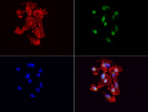 VBP1 Antibody - Immunofluorescent staining of MDA-MB-231 cells using anti-VBP1 mouse monoclonal antibody  green, 1:100). Actin filaments were labeled with TRITC-phalloidin. (red), and nuclear with DAPI. (blue).
