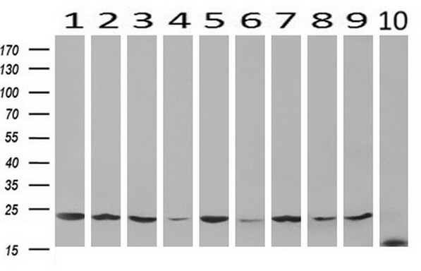 VBP1 Antibody - Western blot analysis of extracts. (10ug) from 10 Human tissue by using anti-VBP1 monoclonal antibody at 1:200. (1: Testis; 2: Omentum; 3: Uterus; 4: Breast; 5: Brain; 6: Liver; 7: Ovary; 8: Thyroid gland; 9: colon;10: spleen).