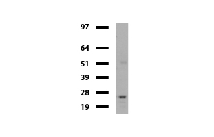 VBP1 Antibody - Western blot of mouse tissue lysates. (20ug) from Ovary. Primary antibody diluation: 1:500. Secondary antibody dilution: Mouse TrueBlot® Ultra. (1:1000).