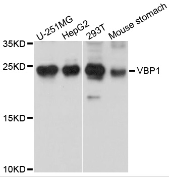 VBP1 Antibody - Western blot analysis of extracts of various cells.