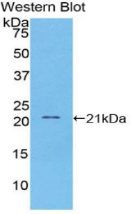 VCAM1 / CD106 Antibody - Western blot of recombinant VCAM1 / VCAM-1 / CD106.  This image was taken for the unconjugated form of this product. Other forms have not been tested.