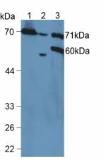 VCAM1 / CD106 Antibody - Western Blot; Sample: Lane1: Mouse Kidney Tissue; Lane2: Mouse Placenta Tissue; Lane3: Human Hela Cells.