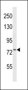 VCAM1 / CD106 Antibody - CD106 Antibody western blot of HepG2 cell line lysates (35 ug/lane). The CD106 antibody detected the CD106 protein (arrow).