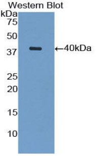 VCAM1 / CD106 Antibody - Western blot of recombinant VCAM1 / VCAM-1 / CD106.  This image was taken for the unconjugated form of this product. Other forms have not been tested.