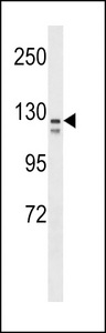 VCAM1 / CD106 Antibody - CD106 Antibody (Ascites)western blot of HL-60 cell line lysates (35 ug/lane). The CD106 antibody detected the CD106 protein (arrow).
