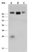 VCAM1 / CD106 Antibody - Anti-VCAM1 rabbit monoclonal antibody at 1:500 dilution. Lane A: NIH 3T3 Whole Cell Lysate. Lane B: Mouse brain tissue lysate. Lane C: Mouse kidney tissue lysate. Lysates/proteins at 30 ug per lane. Secondary: Goat Anti-Rabbit IgG (H+L)/HRP at 1/10000 dilution. Developed using the ECL technique. Performed under reducing conditions. Predicted band size: 81 kDa. Observed band size: 100 kDa.