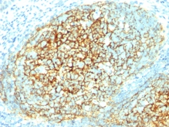 VCAM1 / CD106 Antibody - Formalin-fixed, paraffin-embedded human tonsil stained with VCAM-1 antibody (1.4C3).  This image was taken for the unmodified form of this product. Other forms have not been tested.