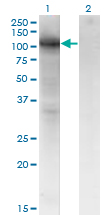 VCAM1 / CD106 Antibody - Western Blot analysis of VCAM1 expression in transfected 293T cell line by VCAM1 monoclonal antibody (M04), clone 1H6.Lane 1: VCAM1 transfected lysate (Predicted MW: 81.3 KDa).Lane 2: Non-transfected lysate.