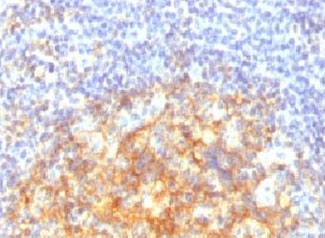 VCAM1 / CD106 Antibody - IHC testing of FFPE human tonsil with VCAM-1 antibody (clone CDLA106).  This image was taken for the unmodified form of this product. Other forms have not been tested.
