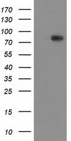 VCAM1 / CD106 Antibody - HEK293T cells were transfected with the pCMV6-ENTRY control (Left lane) or pCMV6-ENTRY VCAM1 (Right lane) cDNA for 48 hrs and lysed. Equivalent amounts of cell lysates (5 ug per lane) were separated by SDS-PAGE and immunoblotted with anti-VCAM1.