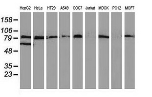 VCAM1 / CD106 Antibody - Western blot of extracts (35 ug) from 9 different cell lines by using anti-VCAM1 monoclonal antibody.