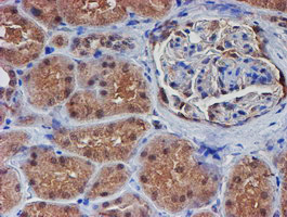 VCAM1 / CD106 Antibody - IHC of paraffin-embedded Human Kidney tissue using anti-VCAM1 mouse monoclonal antibody.