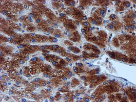 VCAM1 / CD106 Antibody - IHC of paraffin-embedded Human liver tissue using anti-VCAM1 mouse monoclonal antibody.