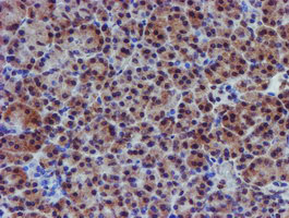 VCAM1 / CD106 Antibody - IHC of paraffin-embedded Human pancreas tissue using anti-VCAM1 mouse monoclonal antibody.
