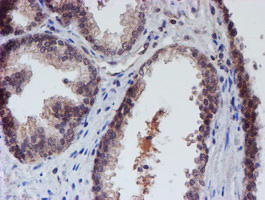 VCAM1 / CD106 Antibody - IHC of paraffin-embedded Human prostate tissue using anti-VCAM1 mouse monoclonal antibody.
