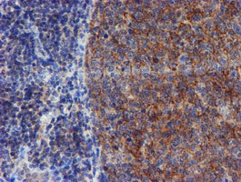 VCAM1 / CD106 Antibody - IHC of paraffin-embedded Human tonsil using anti-VCAM1 mouse monoclonal antibody.