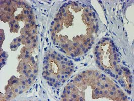 VCAM1 / CD106 Antibody - IHC of paraffin-embedded Human breast tissue using anti-VCAM1 mouse monoclonal antibody.