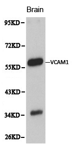 VCAM1 / CD106 Antibody - Western blot of VCAM1 pAb in extracts from mouse brain tissue.