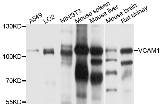 VCAM1 / CD106 Antibody - Western blot analysis of extracts of various cells.