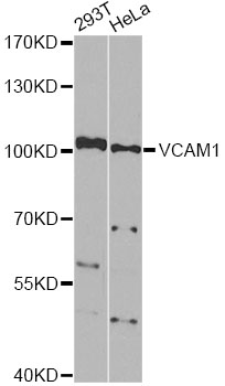 VCAM1 / CD106 Antibody - Western blot analysis of extracts of various cell lines, using VCAM1 antibody at 1:1000 dilution. The secondary antibody used was an HRP Goat Anti-Rabbit IgG (H+L) at 1:10000 dilution. Lysates were loaded 25ug per lane and 3% nonfat dry milk in TBST was used for blocking. An ECL Kit was used for detection and the exposure time was 90s.