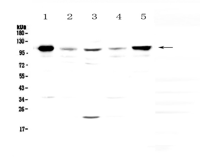 VCAM1 / CD106 Antibody - Western blot - Anti-VCAM1/Cd106 Picoband antibody