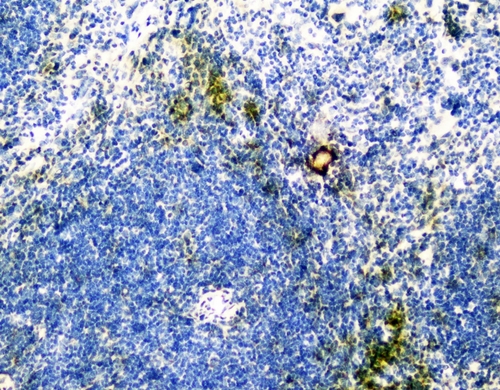 VCAM1 / CD106 Antibody - IHC analysis of VCAM1 using anti-VCAM1 antibody. VCAM1 was detected in paraffin-embedded section of mouse spleen tissues. Heat mediated antigen retrieval was performed in citrate buffer (pH6, epitope retrieval solution) for 20 mins. The tissue section was blocked with 10% goat serum. The tissue section was then incubated with 1µg/ml rabbit anti-VCAM1 Antibody overnight at 4°C. Biotinylated goat anti-rabbit IgG was used as secondary antibody and incubated for 30 minutes at 37°C. The tissue section was developed using Strepavidin-Biotin-Complex (SABC) with DAB as the chromogen.