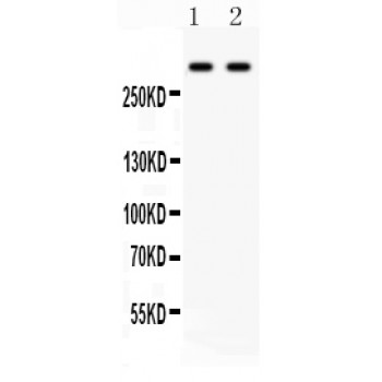 VCAN / Versican Antibody - Versican antibody Western blot. All lanes: Anti Versican at 0.5 ug/ml. Lane 1: Rat Brain Tissue Lysate at 50 ug. Lane 2: HEPA Whole Cell Lysate at 40 ug. Predicted band size: 373 kD. Observed band size: 373 kD.